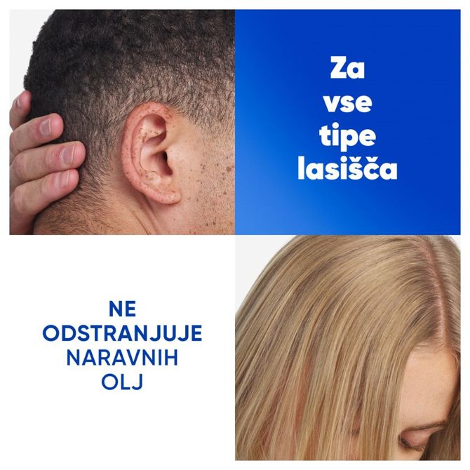Šampon za lase Head & Shoulders Apple Fresh proti prhljaju 500 ml 4